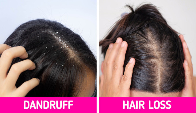 11 dấu hiệu cơ thể cảnh báo vấn đề về sức khỏe