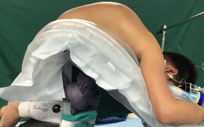 Hà Nội chỉnh cột sống cho người đàn ông 10 năm không thể nằm ngửa