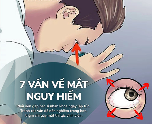 7 vấn đề nguy hiểm về mắt cần phải đến gặp bác sĩ nhãn khoa ngay lập tức