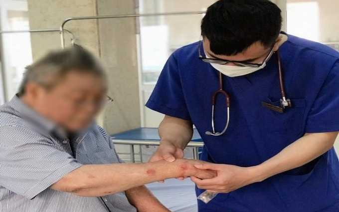Phú Thọ cấp cứu kịp thời bệnh nhân cao tuổi bị suy tuyến thượng thận do tự ý dùng thuốc Corticoid
