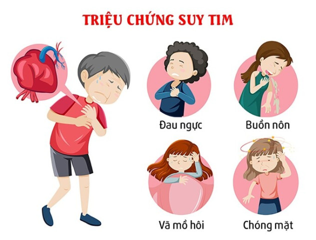 Tầm quan trọng của việc khám sức khỏe tim mạch định kỳ