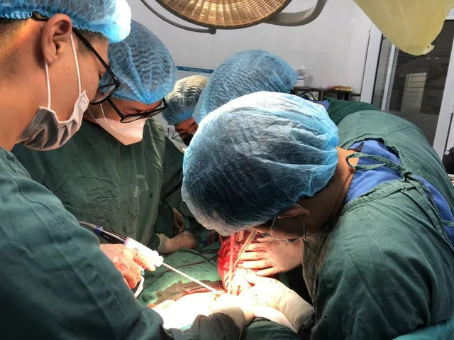 Hà Nội phẫu thuật cắt bỏ thành công khối u khổng lồ trong ổ bụng của một nữ bệnh nhân