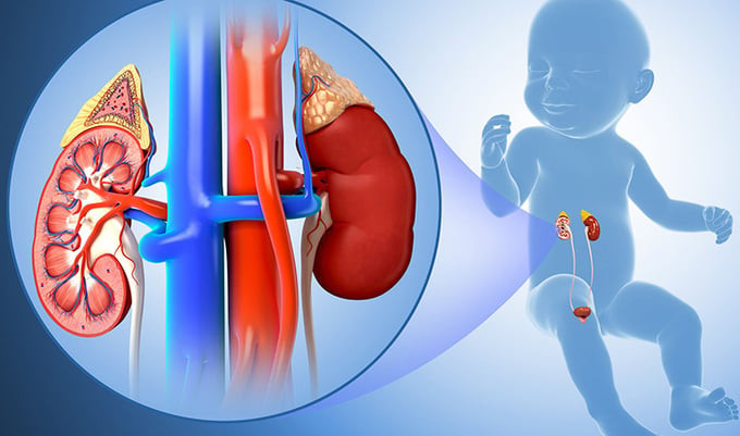 Cha mẹ cần lưu ý về hội chứng thận hư ở trẻ nhỏ