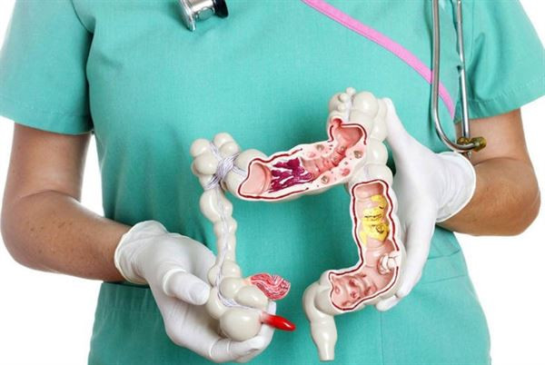 Cách nhận biết các triệu chứng và phòng tránh căn bệnh ung thư đại trực tràng hiệu quả