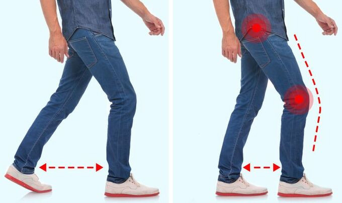 7 thói quen đi bộ tiết lộ các vấn đề về sức khỏe của chúng ta