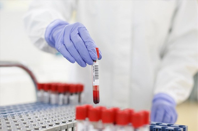 Kết luận thanh tra việc mua sắm trang thiết bị, vật tư y tế, sinh phẩm, kít xét nghiệm, vaccine, thuốc phòng, chống dịch COVID-19 tại Bộ Y tế