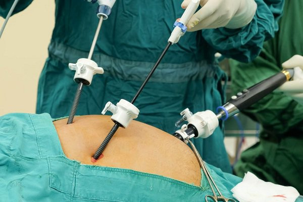Kỹ thuật phẫu thuật nội soi hoàn toàn điều trị ung thư dạ dày và đại tràng