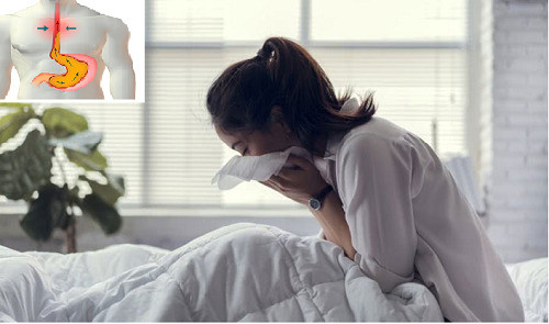 Mẹo chữa trào ngược dạ dày gây ho