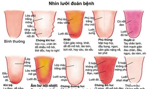 Nhìn lưỡi, chẩn bệnh cho bản thân