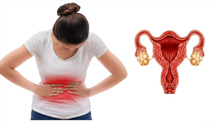 7 loại thực phẩm cân bằng nội tiết tố tốt nhất để quản lý Hội chứng buồng chứng đa nang