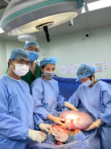Cần Thơ cùng lúc phẫu thuật lấy thai và cắt khối u nặng 8kg cho một sản phụ