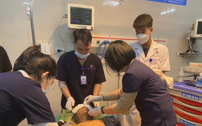 Phú Thọ cấp cứu bệnh nhi 14 tuổi bị biến dạng khuôn mặt sau khi đắp lá cây tại nhà chữa bỏng