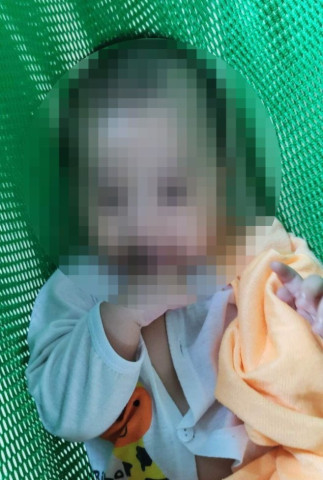 TP. HCM: Bé 6 tháng tuổi bị bảo mẫu bạo hành dẫn đến tổn thương não nghiêm trọng