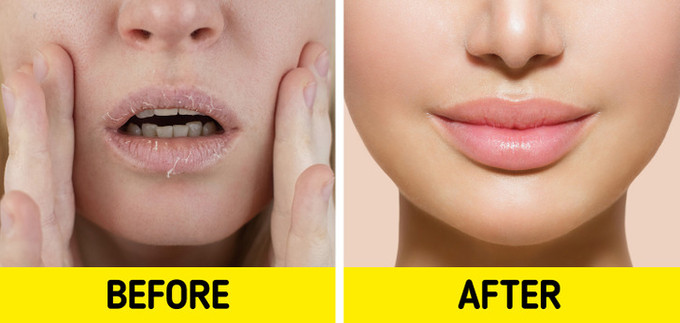 8 biện pháp khắc phục đôi môi khô