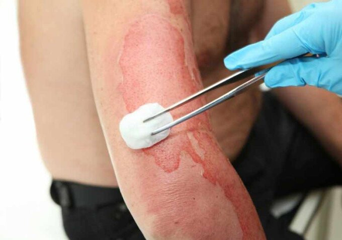Cẩn trọng chấn thương nặng do điện giật