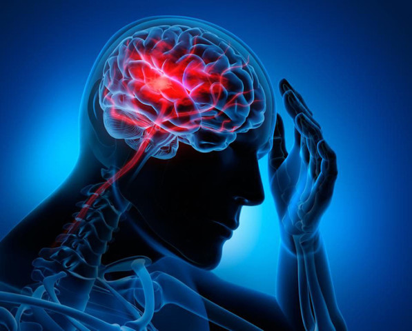 Số người bị đột quỵ khi trời lạnh gia tăng