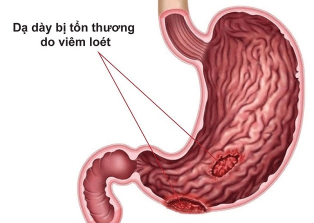 Những bệnh thường gặp sau Tết