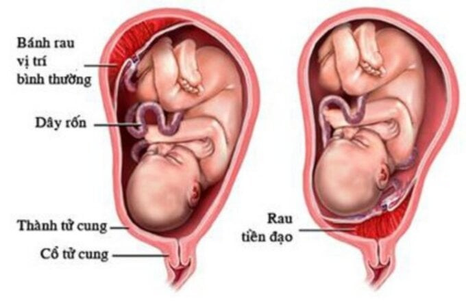 Những điều cần biết về rau tiền đạo