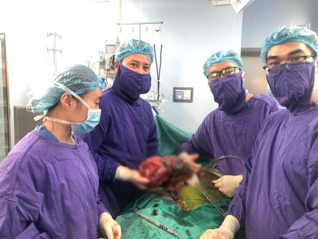 Hà Nội phẫu thuật thành công cho bệnh nhân nữ có khối u nặng 2,8kg