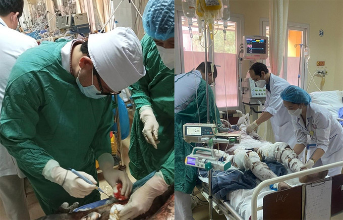 Quảng Ninh kịp thời hỗ trợ cấp cứu và điều trị các bệnh nhân bị bỏng trong vụ nổ hầm tầu Oriental Glory