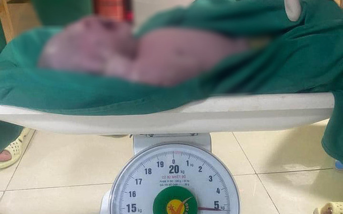 Phú Thọ mổ bắt thành công bé sơ sinh nặng 5,4kg cho sản phụ 21 tuổi