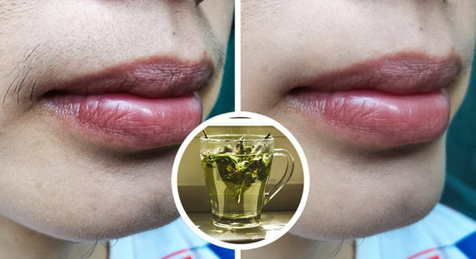 6 cách tự nhiên để ngăn chặn sự phát triển của lông mặt