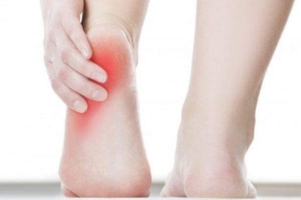 Điều trị viêm gân gót chân sao cho đúng?