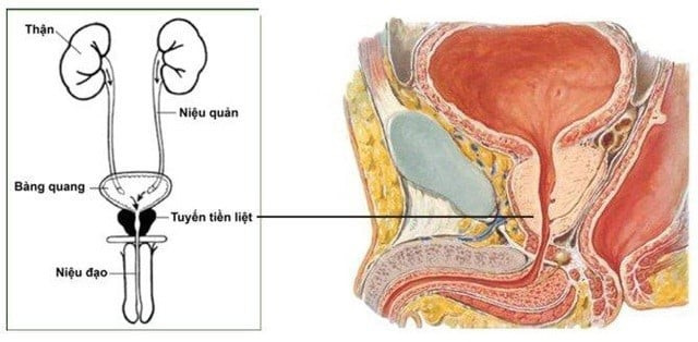 Những điều cần biết về bệnh ung thư tiền liệt tuyến ở nam giới