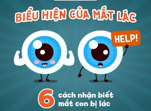 Chuyên gia chỉ ra 6 cách nhận biết mắt trẻ bị lác