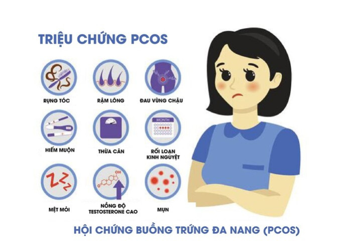 Tìm hiểu về hội chứng buồn trứng đa nang ở phụ nữ