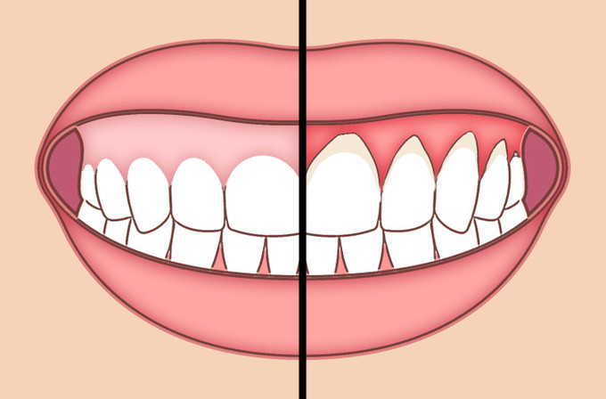 6 thói quen tốt hàng ngày cho răng khoẻ mạnh