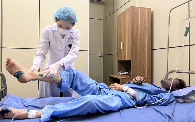 Thái Nguyên tiếp nhận điều trị thành công một ca bệnh nhập viện do hoại tử thượng bì nhiễm độc