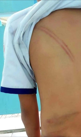 Cà Mau yêu cầu cần có giải pháp bảo vệ trẻ bị bạo hành