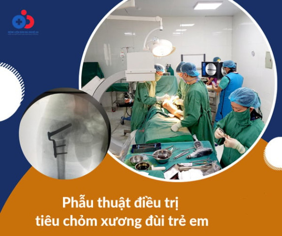 Nghệ An phẫu thuật điều trị tiêu chỏm xương đùi cho bệnh nhi 10 tuổi