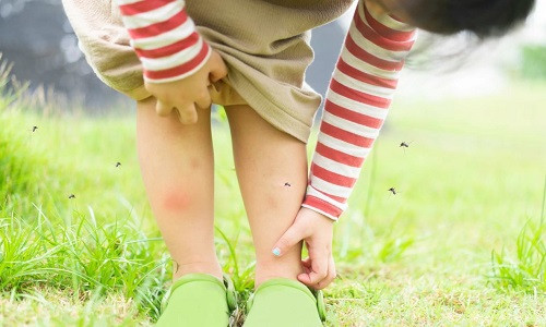 Mẹo nhỏ giúp bảo vệ con khỏi muỗi đốt khi thời tiết nóng ẩm