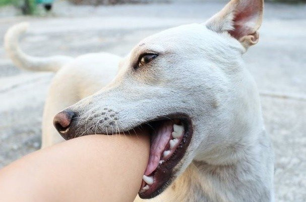 Nghệ An tiếp nhận 2 trường hợp bệnh nhi cấp cứu trong tình trạng nguy kịch nghi do chó dại cắn