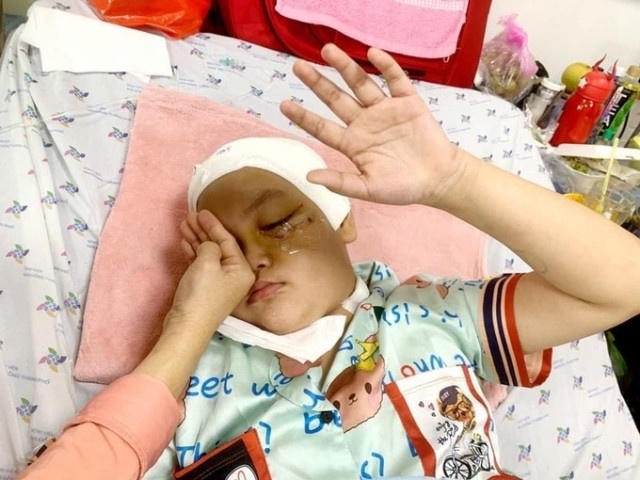 Cách xử trí chấn thương ở mắt tại nhà