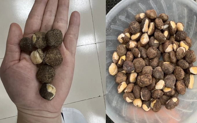 Lạng Sơn: Một người đàn ông ăn quả lạ bị ngộ độc phải nhập viện