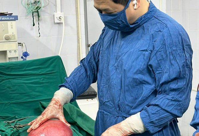 Hà Nội phẫu thuật thành công loại bỏ khối u xơ tử cung nặng 3 kg cho 1 nữ bệnh nhân