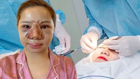 Phẫu thuật thẩm mỹ có nguy hiểm không?