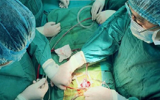 Nghệ An: Bé sơ sinh phải trải qua 4 lần phẫu thuật để sửa các dị tật trong 20 ngày đầu đời