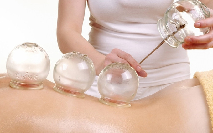 Phú Thọ: Một bệnh nhân nữ bị bỏng cồn độ II sau khi đi giác hơi