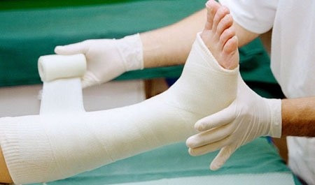 Cách chăm sóc trẻ bị bó bột sau gãy xương