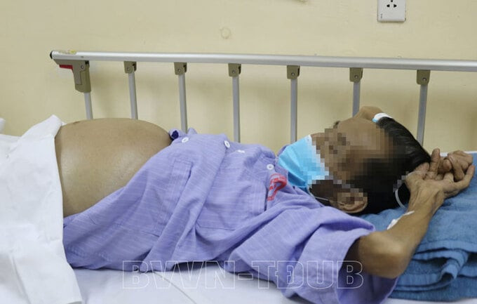 Quảng Ninh: Người đàn ông tự ý mua, sử dụng thuốc nam không rõ nguồn gốc trị xơ gan khiến biến chứng nặng nề