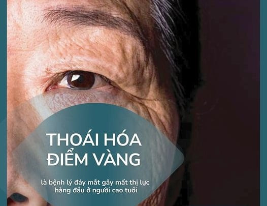 Thoái hóa điểm vàng là bệnh lý đáy mắt gây mất thị lực hàng đầu ở người cao tuổi
