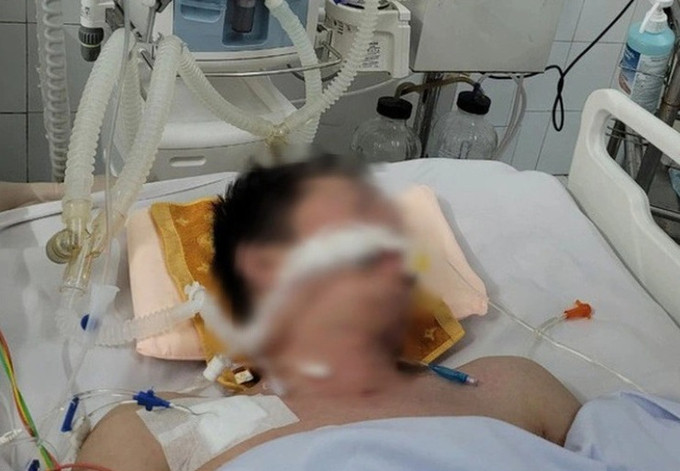 Hà Nội cứu sống bệnh nhân viêm màng não trên nền bệnh Lupus ban đỏ hệ thống