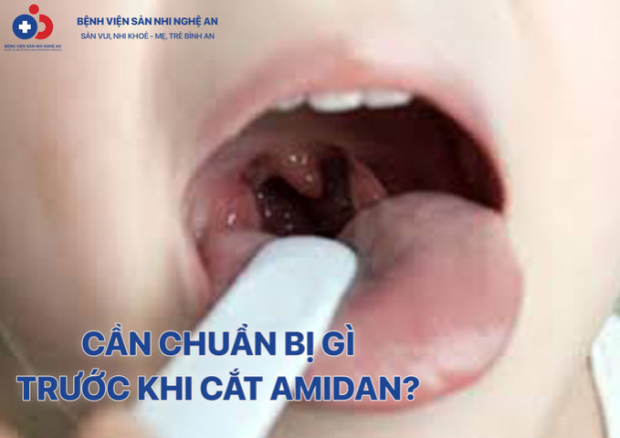Cần chuẩn bị gì trước khi cắt amidan?