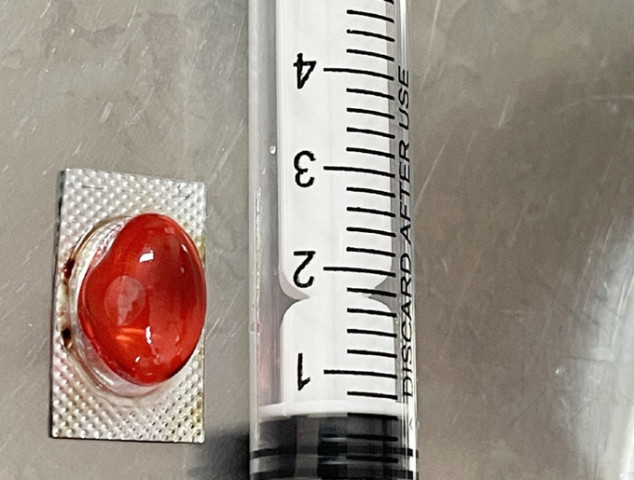 Hà Tĩnh gắp thành công viên thuốc còn nguyên vỏ trong hành tá tràng một bệnh nhân
