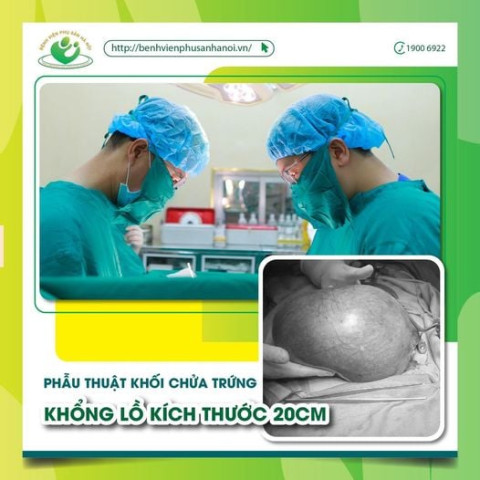 Hà Nội phẫu thuật khối chửa trứng khổng lồ kích thước 20cm cho 1 phụ nữ 43 tuổi