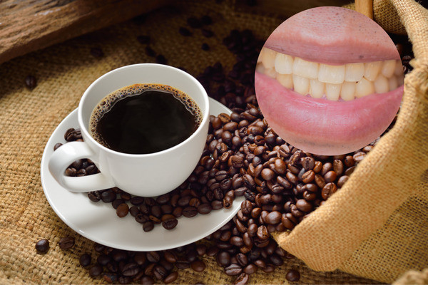 Giải pháp ngăn ngừa khả năng gây hại của cà phê đối với răng miệng